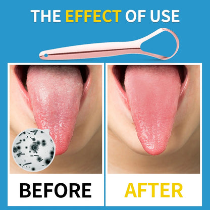 Tongue Scraper with Cases 100% Stainless Steel Tongue Cleaner for Bad